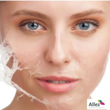 Curso de Peeling